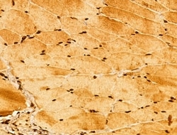 Invitrogen NOB1 Polyclonal Antibody 100 &mu;L; Unconjugated:Antibodies,