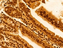 Invitrogen NOB1 Polyclonal Antibody 100 &mu;L; Unconjugated:Antibodies,