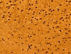 Invitrogen NOB1 Polyclonal Antibody 100 &mu;L; Unconjugated:Antibodies,