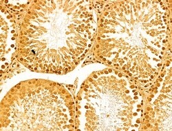 Invitrogen NOB1 Polyclonal Antibody 100 &mu;L; Unconjugated:Antibodies,