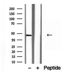Invitrogen NOB1 Polyclonal Antibody 100 &mu;L; Unconjugated:Antibodies,