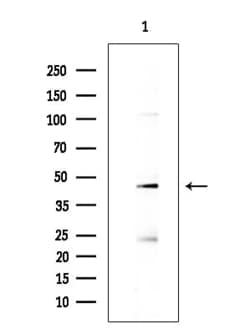 Invitrogen NOB1 Polyclonal Antibody 100 &mu;L; Unconjugated:Antibodies,