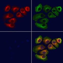 Invitrogen TIMM22 Polyclonal Antibody 100 &mu;L; Unconjugated:Antibodies,