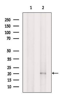 Invitrogen TIMM22 Polyclonal Antibody 100 &mu;L; Unconjugated:Antibodies,