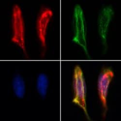 Invitrogen BCO2 Polyclonal Antibody 100 &mu;L; Unconjugated:Antibodies,