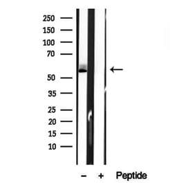 Invitrogen BCO2 Polyclonal Antibody 100 &mu;L; Unconjugated:Antibodies,