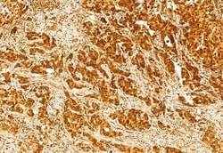 Invitrogen GSDMD Polyclonal Antibody 100 &mu;L; Unconjugated:Antibodies,
