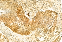 Invitrogen GSDMD Polyclonal Antibody 100 &mu;L; Unconjugated:Antibodies,