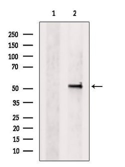 Invitrogen GSDMD Polyclonal Antibody 100 &mu;L; Unconjugated:Antibodies,