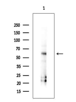 Invitrogen GSDMD Polyclonal Antibody 100 &mu;L; Unconjugated:Antibodies,