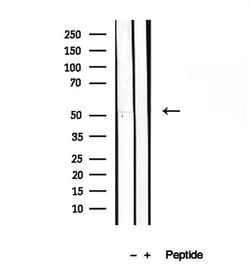 Invitrogen GSDMD Polyclonal Antibody 100 &mu;L; Unconjugated:Antibodies,