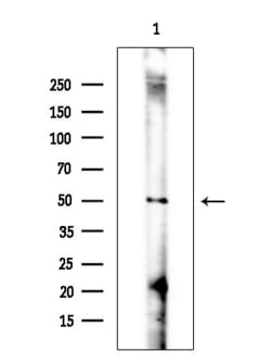 Invitrogen GSDMD Polyclonal Antibody 100 &mu;L; Unconjugated:Antibodies,