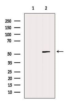 Invitrogen GSDMD Polyclonal Antibody 100 &mu;L; Unconjugated:Antibodies,