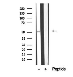 Invitrogen BBS4 Polyclonal Antibody 100 &mu;L; Unconjugated:Antikörper