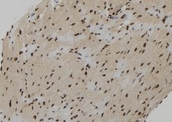 Invitrogen CXXC5 Polyclonal Antibody 100 &mu;L; Unconjugated:Antibodies,