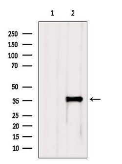Invitrogen CXXC5 Polyclonal Antibody 100 &mu;L; Unconjugated:Antibodies,