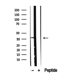 Invitrogen CXXC5 Polyclonal Antibody 100 &mu;L; Unconjugated:Antibodies,