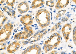Invitrogen PDHX Polyclonal Antibody 100 &mu;L; Unconjugated:Antibodies,