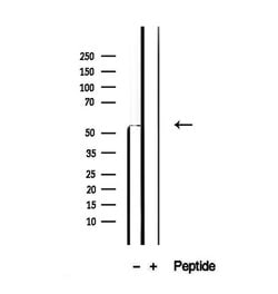 Invitrogen PDHX Polyclonal Antibody 100 &mu;L; Unconjugated:Antibodies,