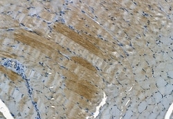 Invitrogen PDLIM3 Polyclonal Antibody 100 &mu;L | Buy Online | Invitrogen&trade; | Fisher Scientific