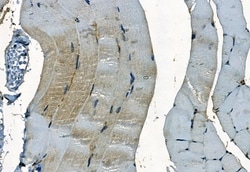 Invitrogen PDLIM3 Polyclonal Antibody 100 &mu;L | Buy Online | Invitrogen&trade; | Fisher Scientific