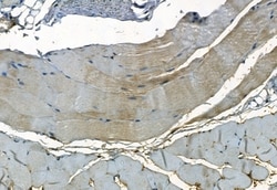 Invitrogen PDLIM3 Polyclonal Antibody 100 &mu;L | Buy Online | Invitrogen&trade; | Fisher Scientific