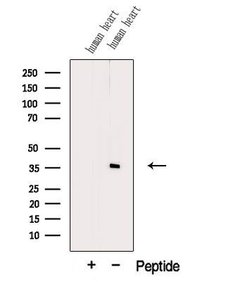 Invitrogen PDLIM3 Polyclonal Antibody 100 &mu;L | Buy Online | Invitrogen&trade; | Fisher Scientific