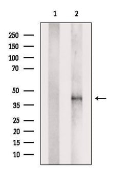 Invitrogen PDLIM3 Polyclonal Antibody 100 &mu;L | Buy Online | Invitrogen&trade; | Fisher Scientific
