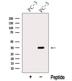 Invitrogen ARPC2 Polyclonal Antibody 100 &mu;L; Unconjugated:Antibodies,