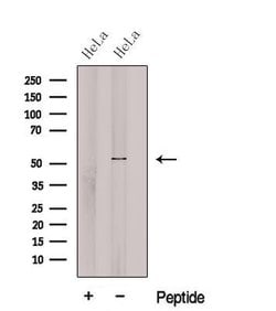 Invitrogen cGAS Polyclonal Antibody 100 &mu;L; Unconjugated:Antibodies,