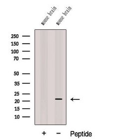 Invitrogen CPLX3 Polyclonal Antibody 100 &mu;L; Unconjugated:Anticuerpos