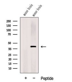 Invitrogen DNAJB12 Polyclonal Antibody 100 &mu;L; Unconjugated:Antibodies,