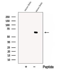 Invitrogen CRMP5 Polyclonal Antibody 100 &mu;L; Unconjugated:Antibodies,
