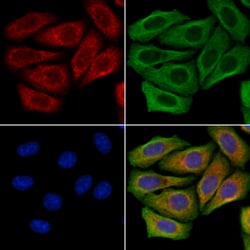 Invitrogen FUT6 Polyclonal Antibody 100 &mu;L; Unconjugated:Antibodies,
