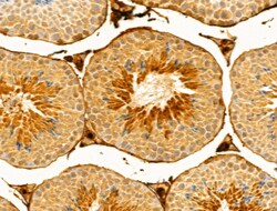Invitrogen FUT6 Polyclonal Antibody 100 &mu;L; Unconjugated:Antibodies,