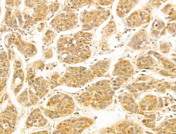 Invitrogen FUT6 Polyclonal Antibody 100 &mu;L; Unconjugated:Antibodies,
