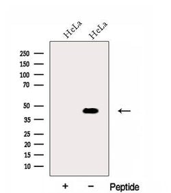 Invitrogen FUT6 Polyclonal Antibody 100 &mu;L; Unconjugated:Antibodies,