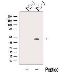 KLF6 Polyclonal Antibody, Invitrogen 100 &mu;L; Unconjugated:Antibodies,