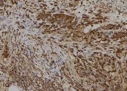Invitrogen SLC5A5 Polyclonal Antibody 100 &mu;L | Buy Online | Invitrogen&trade; | Fisher Scientific