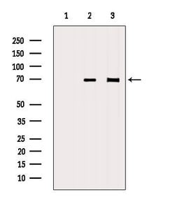 Invitrogen SLC5A5 Polyclonal Antibody 100 &mu;L | Buy Online | Invitrogen&trade; | Fisher Scientific
