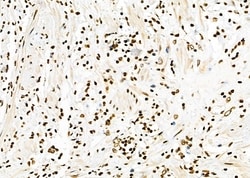 Invitrogen APITD1 Polyclonal Antibody 100 &mu;L; Unconjugated:Antibodies,