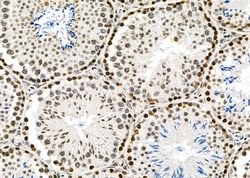 Invitrogen APITD1 Polyclonal Antibody 100 &mu;L; Unconjugated:Antibodies,