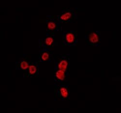 Invitrogen TAF1B Polyclonal Antibody 100 &mu;L | Buy Online | Invitrogen&trade; | Fisher Scientific