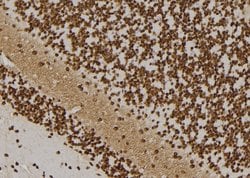 Invitrogen TAF1B Polyclonal Antibody 100 &mu;L | Buy Online | Invitrogen&trade; | Fisher Scientific