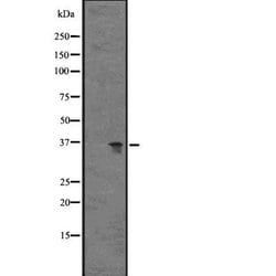 Invitrogen GPR77 Polyclonal Antibody 100 &mu;L; Unconjugated:Antibodies,