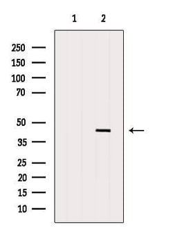 Invitrogen HLA-ABC Polyclonal Antibody 100 &mu;L | Buy Online | Invitrogen&trade; | Fisher Scientific