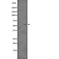 Phospho-p57 Kip2 (Thr310) Polyclonal Antibody
