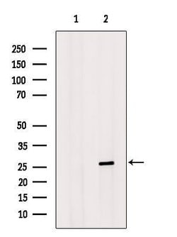 Invitrogen HOXC6 Polyclonal Antibody 100 &mu;L; Unconjugated:Antibodies,