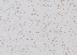 Invitrogen ETK Polyclonal Antibody 100 &mu;L; Unconjugated:Antibodies,