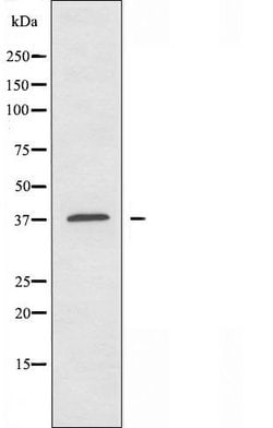 Invitrogen TUSC3 Polyclonal Antibody 100 &mu;L; Unconjugated:Antibodies,